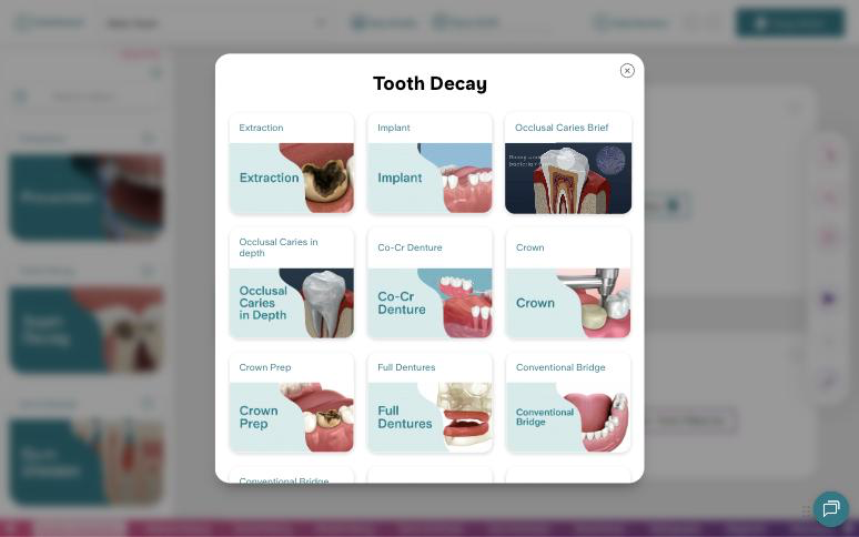 The Tooth Decay collection open, showing video thumbnails, with one previewing on hover