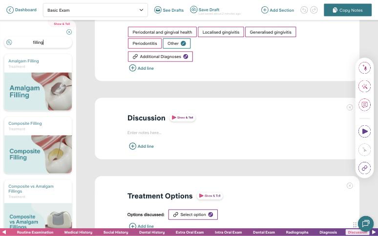 Search results for 'filling', showing Amalgam Filling, Composite Filling and Composite vs Amalgam Fillings